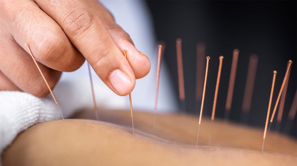 Complete Acupuncturist FengYu Zhao Profile